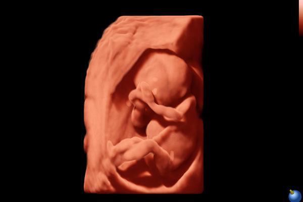 S Live-Effetto-Realistico