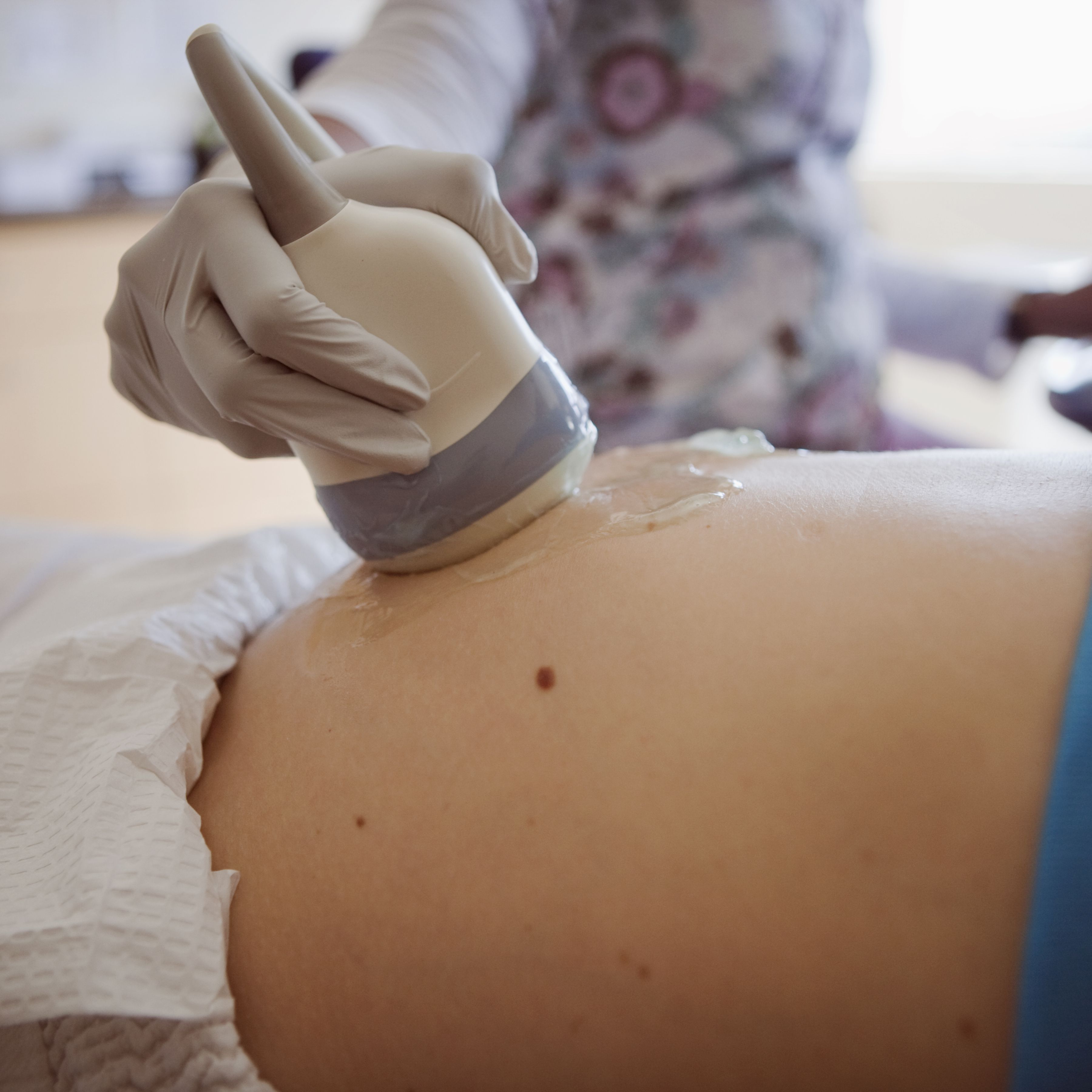 foto%20paciente%203d